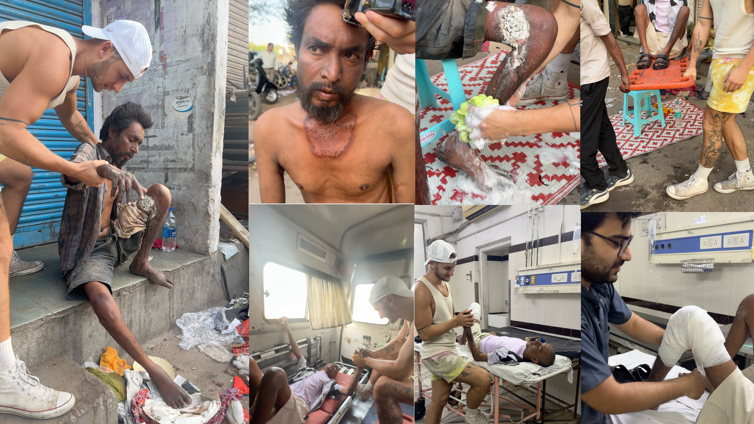 Just in Time: Saving Rohan’s Leg, and His Hope